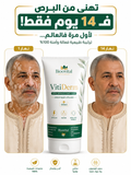 كريم Vitiderm الاصلي
